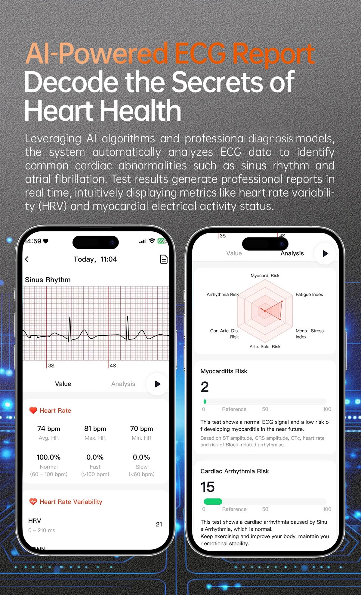 2025 Health Smartwatch for Xiaomi & Huawei ECG + PPG, Blood Pressure, SpO2, Body Analysis, Bluetooth Calling & NFC
